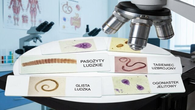 PASOŻYTY W CIELE LUDZI